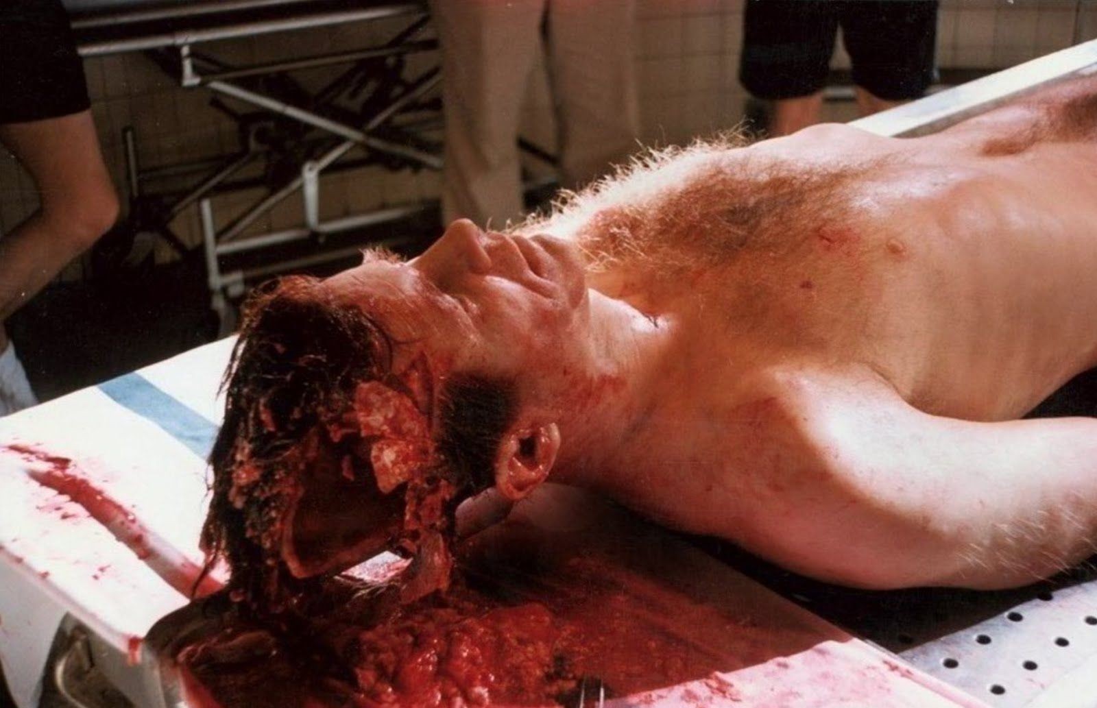 John F. Kennedy autopsy on November 22, 1963